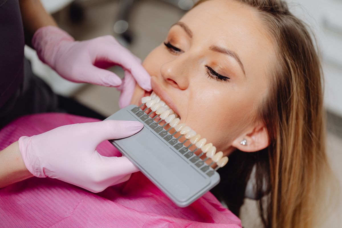 A tooth shade comparison during a dental appointment.